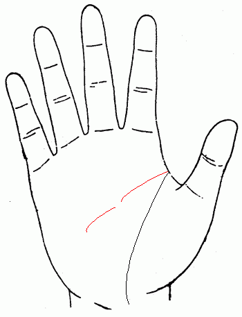 智慧线有明显中断