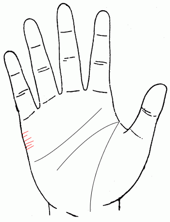 婚姻线多于四条